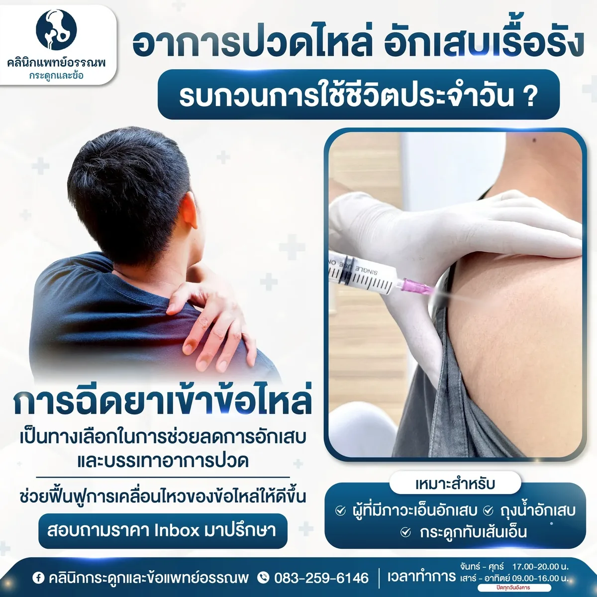 การฉีดยาเข้าข้อไหล่สำหรับอาการปวดไหล่เรื้อรัง