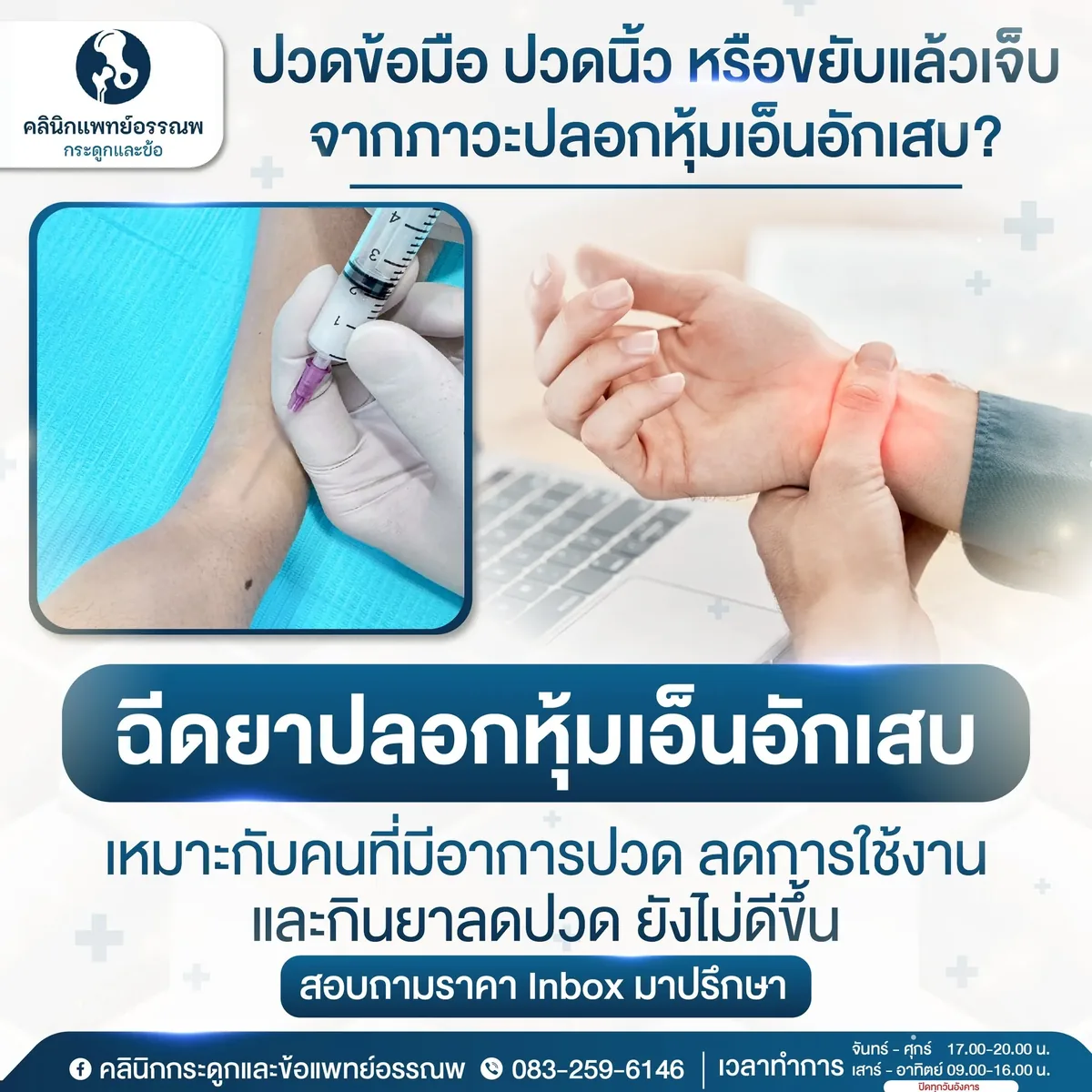 การฉีดยารักษาเอ็นข้อมืออักเสบเดอเกร์แวง